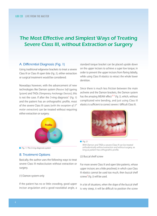 ijoi_vol_33_部分4 ijoi_vol_33_部分4