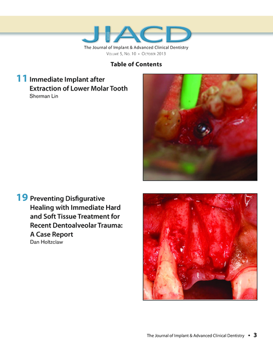 specops_jiacd_201310_部分6 specops_jiacd_201310_部分6
