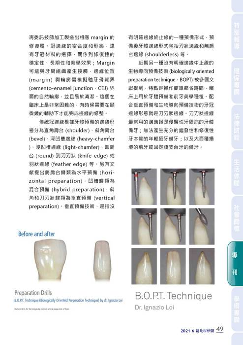 新北市牙醫-2021_6月刊(308期)-備牙專刊 拷貝 新北市牙醫-2021_6月刊(308期)-備牙專刊 拷貝