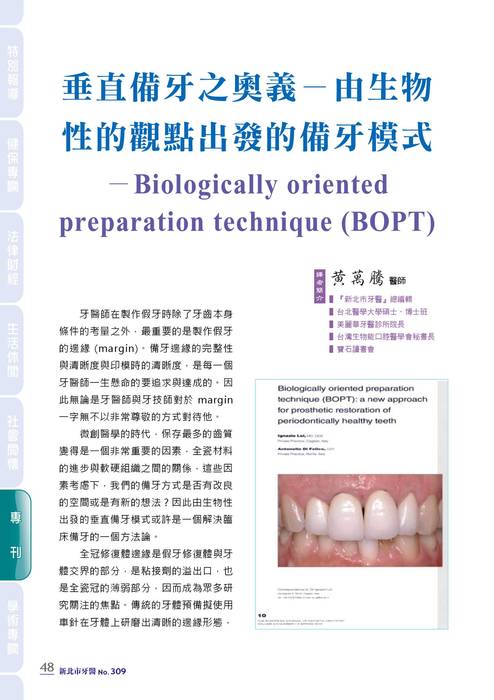 新北市牙醫-2021_6月刊(308期)-備牙專刊 拷貝 新北市牙醫-2021_6月刊(308期)-備牙專刊 拷貝