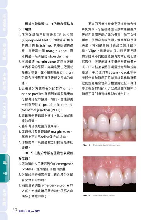 新北市牙醫-2021_6月刊(308期)-備牙專刊 拷貝 新北市牙醫-2021_6月刊(308期)-備牙專刊 拷貝