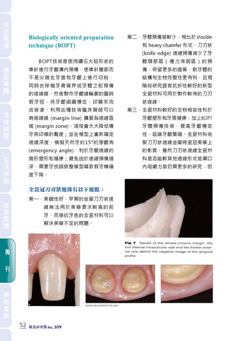 新北市牙醫-2021_6月刊(308期)-備牙專刊 拷貝 新北市牙醫-2021_6月刊(308期)-備牙專刊 拷貝