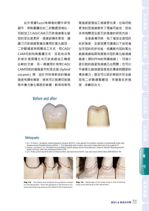 新北市牙醫-2021_6月刊(308期)-備牙專刊 拷貝 新北市牙醫-2021_6月刊(308期)-備牙專刊 拷貝