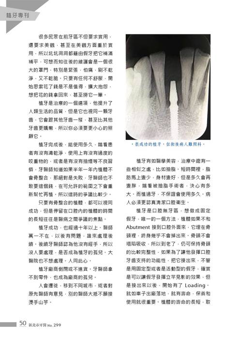 新北市牙醫-2020_7月刊-植牙專刊 新北市牙醫-2020_7月刊-植牙專刊