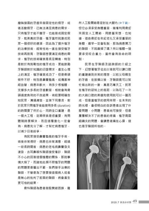新北市牙醫-2020_7月刊-植牙專刊 新北市牙醫-2020_7月刊-植牙專刊